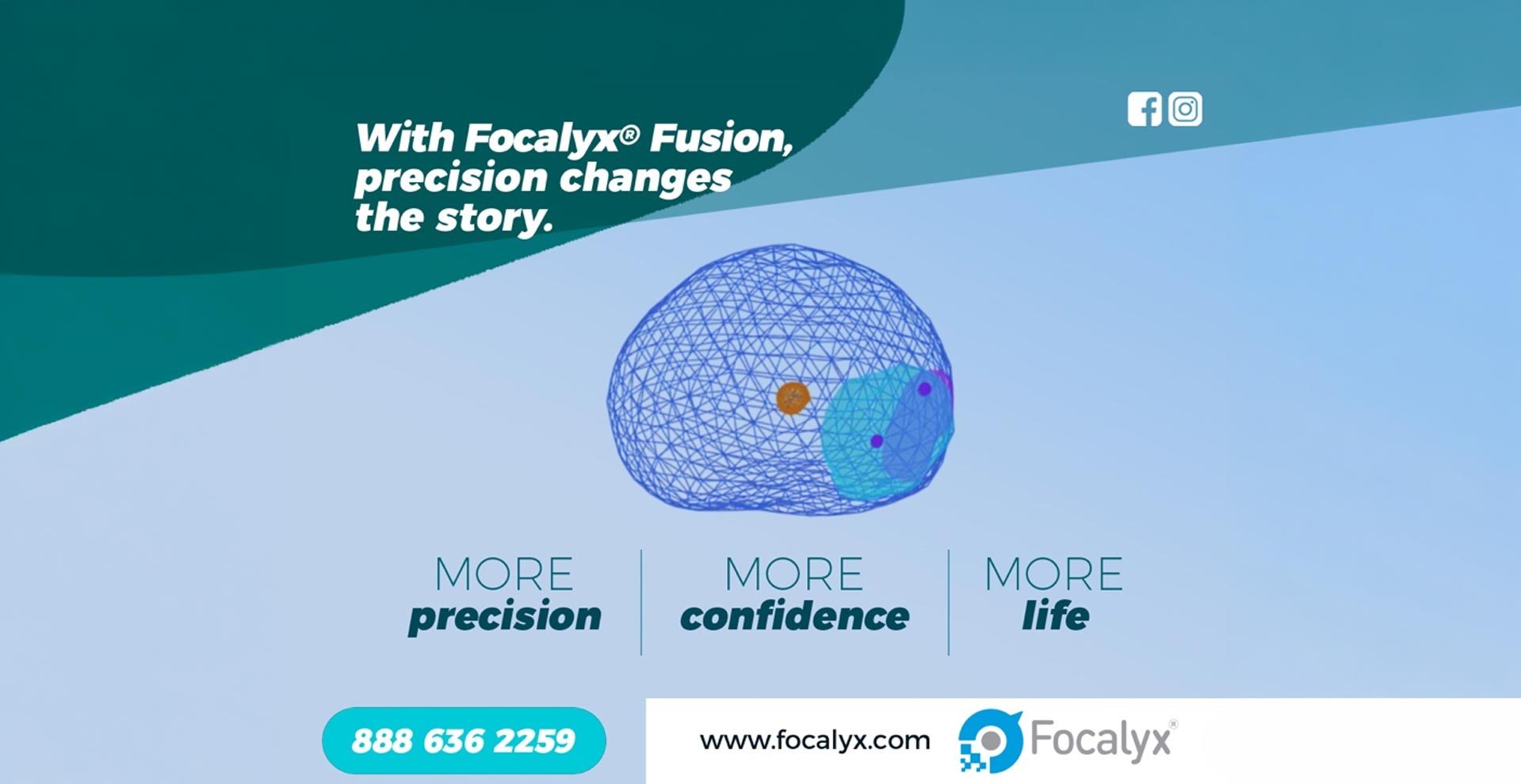 Prostate Cancer: Precision Treatment with Focalyx® Fusion