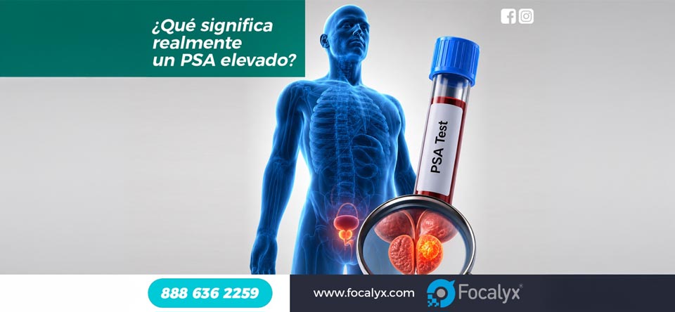 ¿Qué significa realmente un PSA elevado?