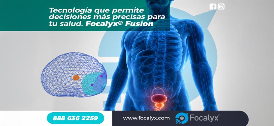Tecnología que permite decisiones más precisas para tu salud. Focalyx Fusion