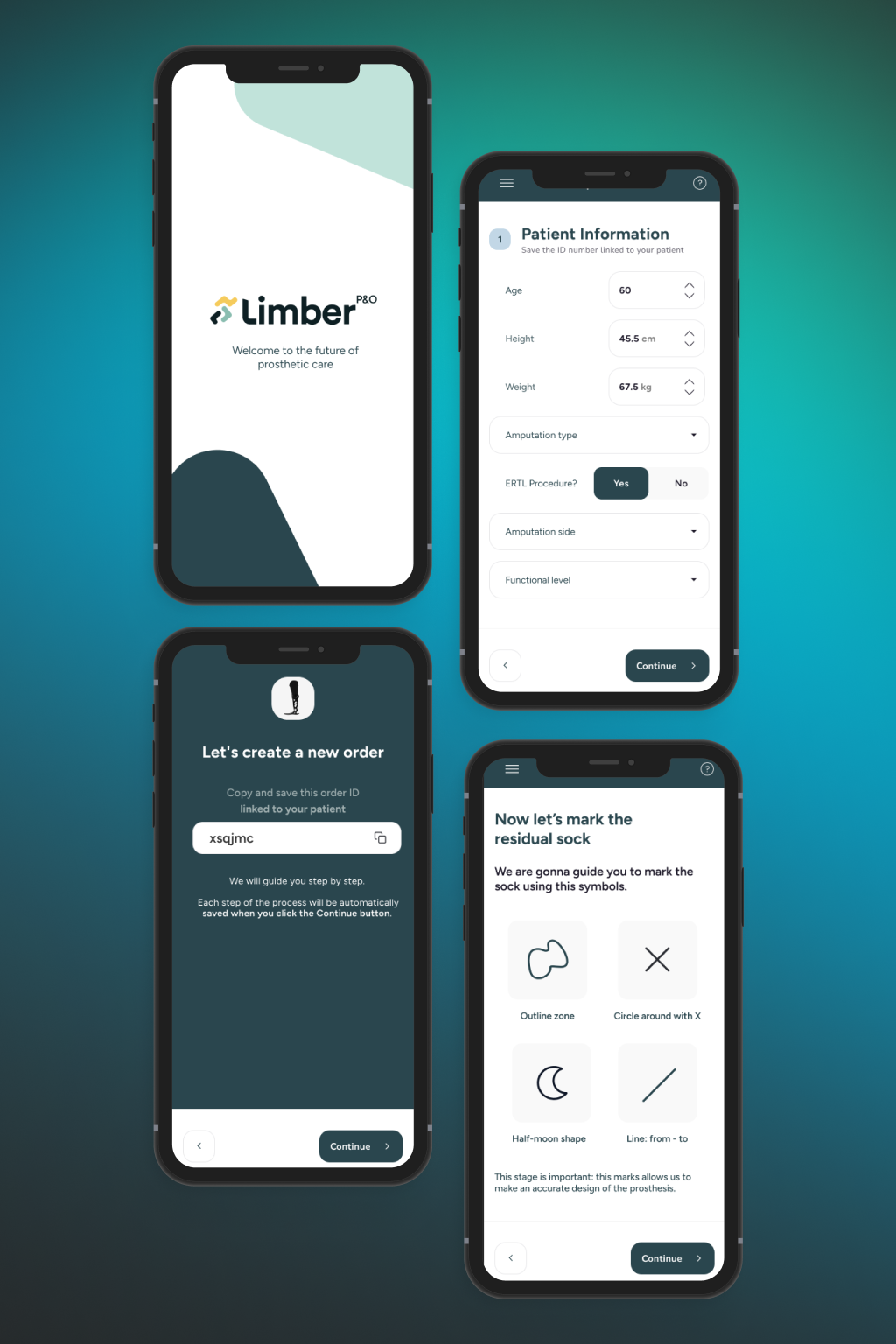 Responsive mobile UI of a SaaS platform focused on pricing strategy and growth value – Software Pricing Partners by MVPossible.