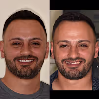 before and after photos - Jolie Smiles in Odessa, FL
