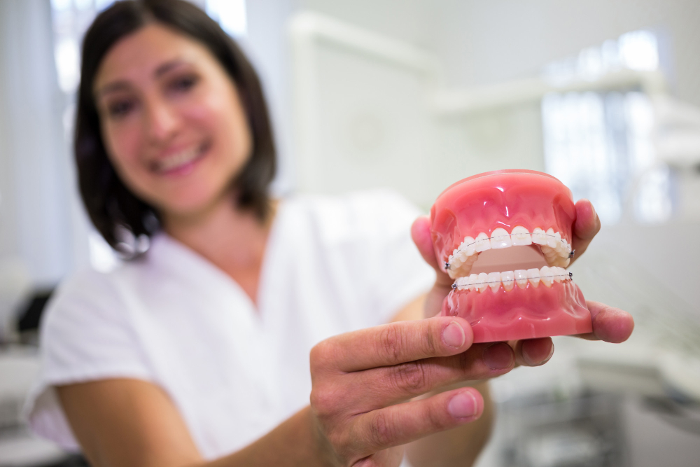 Snap-On Dentures: A Secure and Removable Alternative to Traditional Plates