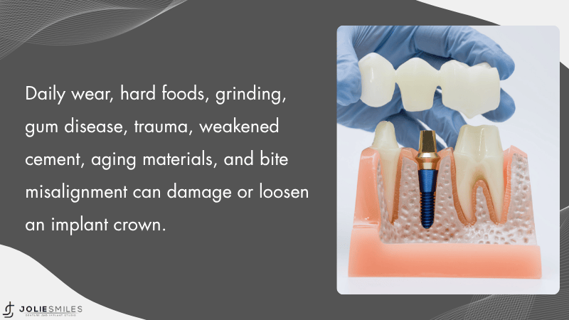 Common Causes: Wear, Damage, and Gum Issues