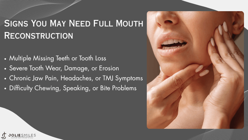 Recognizing Critical Signs You May Need Full Mouth Reconstruction