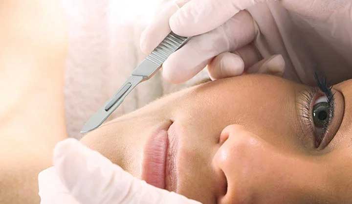 dermaplaning facial denver