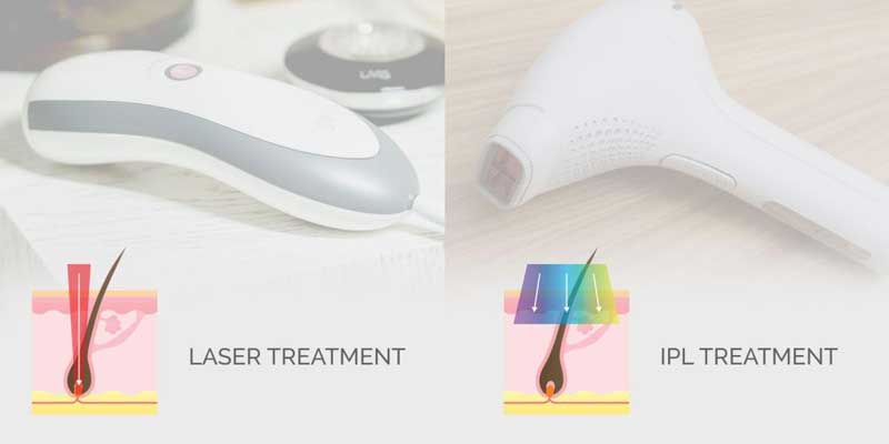 laser hair removal VS IPL (Intense Pulsed Light) Therapy