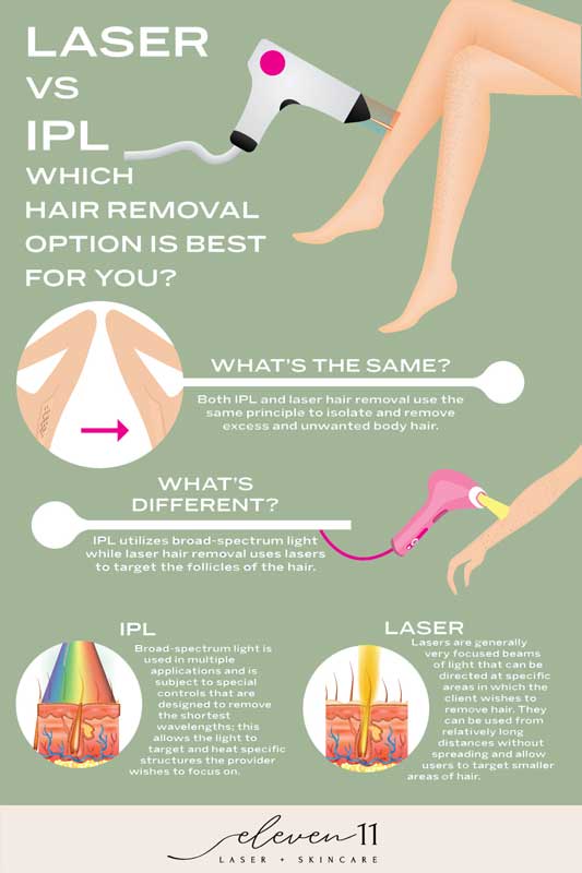 laser hair removal vs IPL whats the difference?