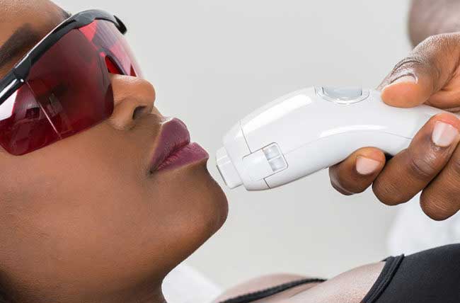 laser hair removal vs IPL whats the difference?