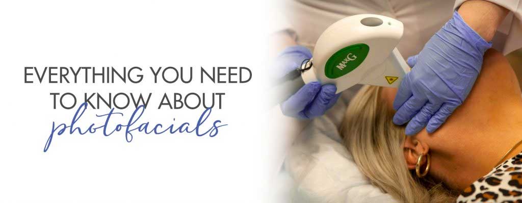 benefits of photofacials