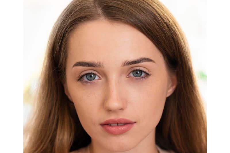 Acne Vulgaris Treatment and causes