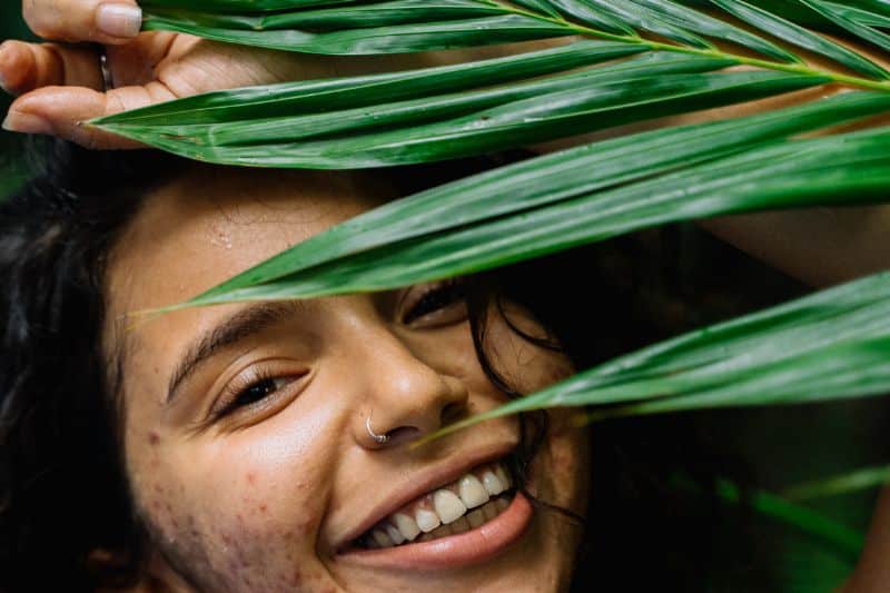 Causes and prevention guide for Post-Inflammatory Hyperpigmentation