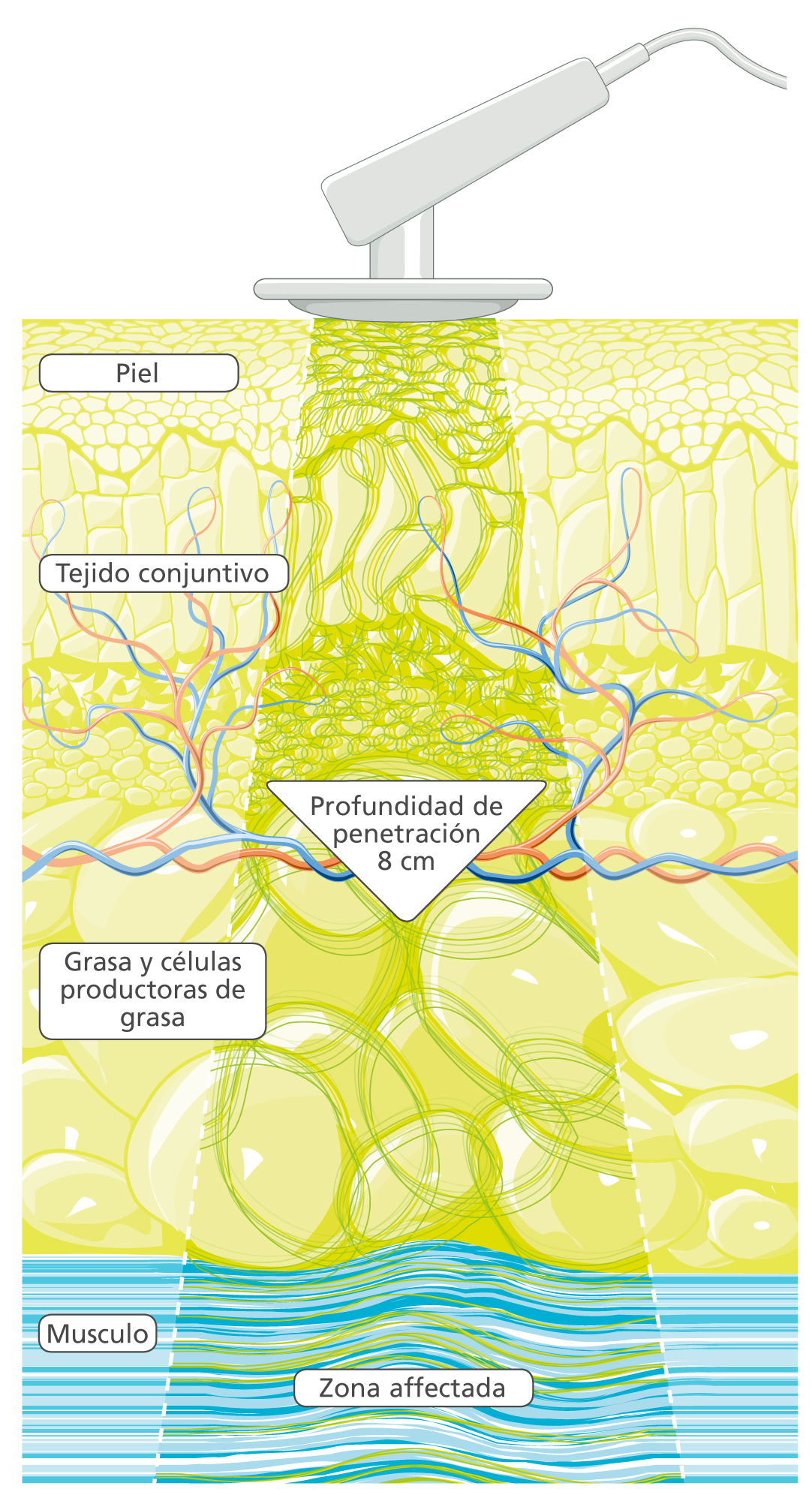 Oscilaciones profundas, profundidad de acción