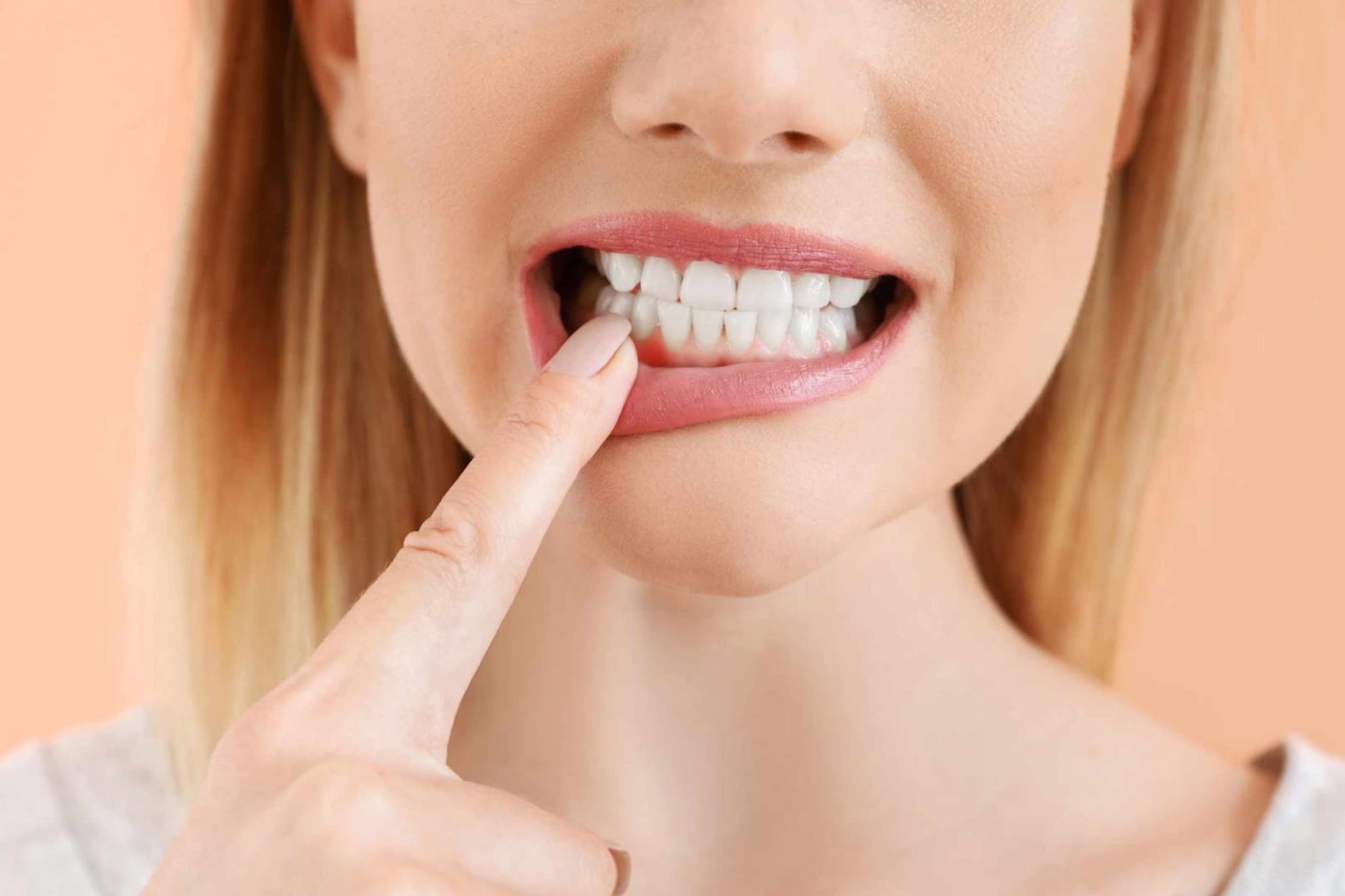 Patient highlighting inflamed gums and gum irritation associated with gingivitis and periodontal disease