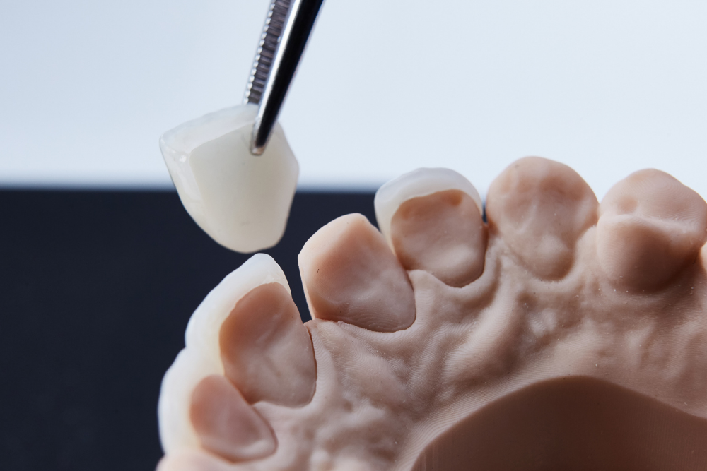 Church View Dental blog post