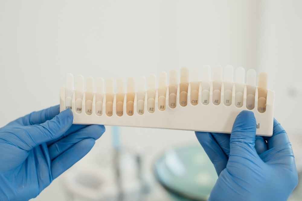 Dental shade guide used to match tooth colour for composite bonding