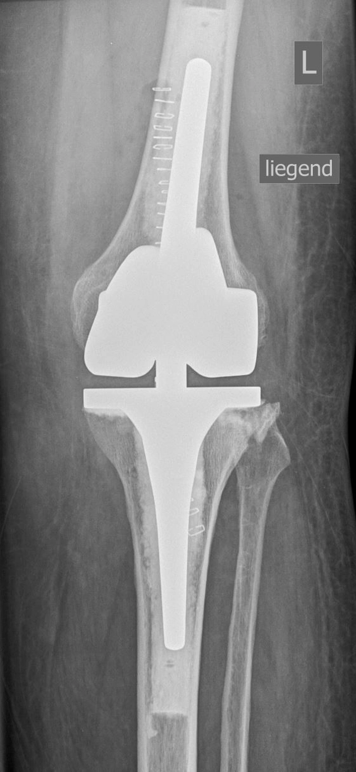STENUM – Fachklinik für Orthopädie – Röntgenaufnahme mit Achsengeführt