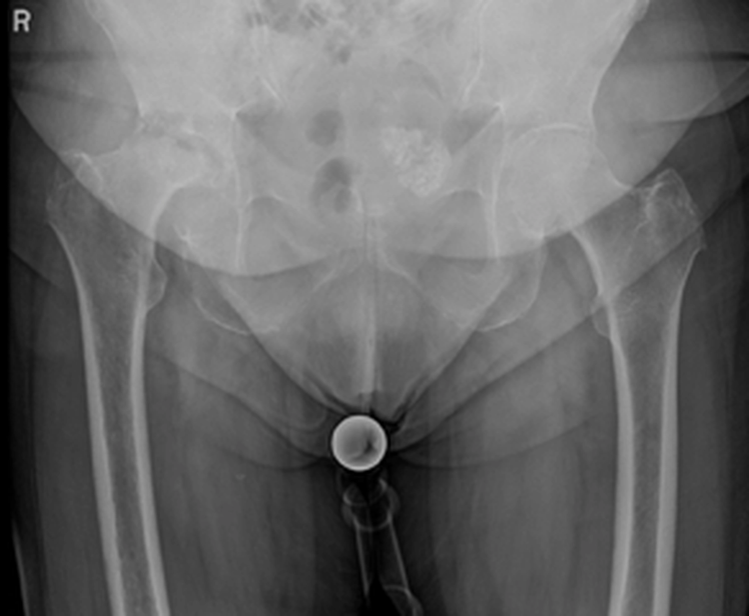 STENUM – Fachklinik für Orthopädie – Röntgenaufnahme des Hüftgelenks