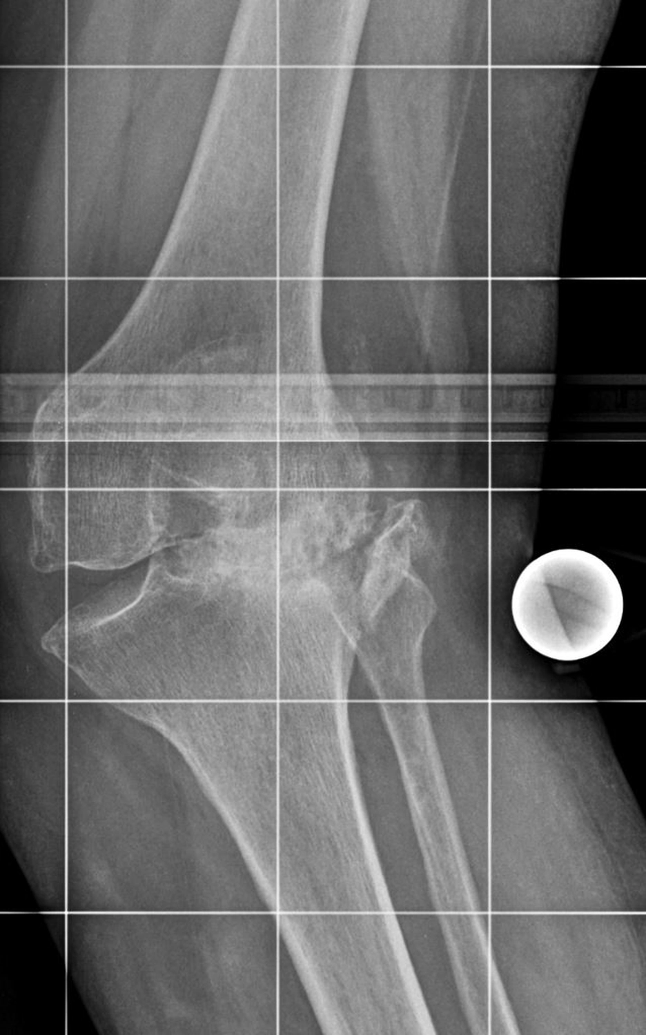 STENUM – Fachklinik für Orthopädie – Röntgenaufnahme mit Achsengeführt