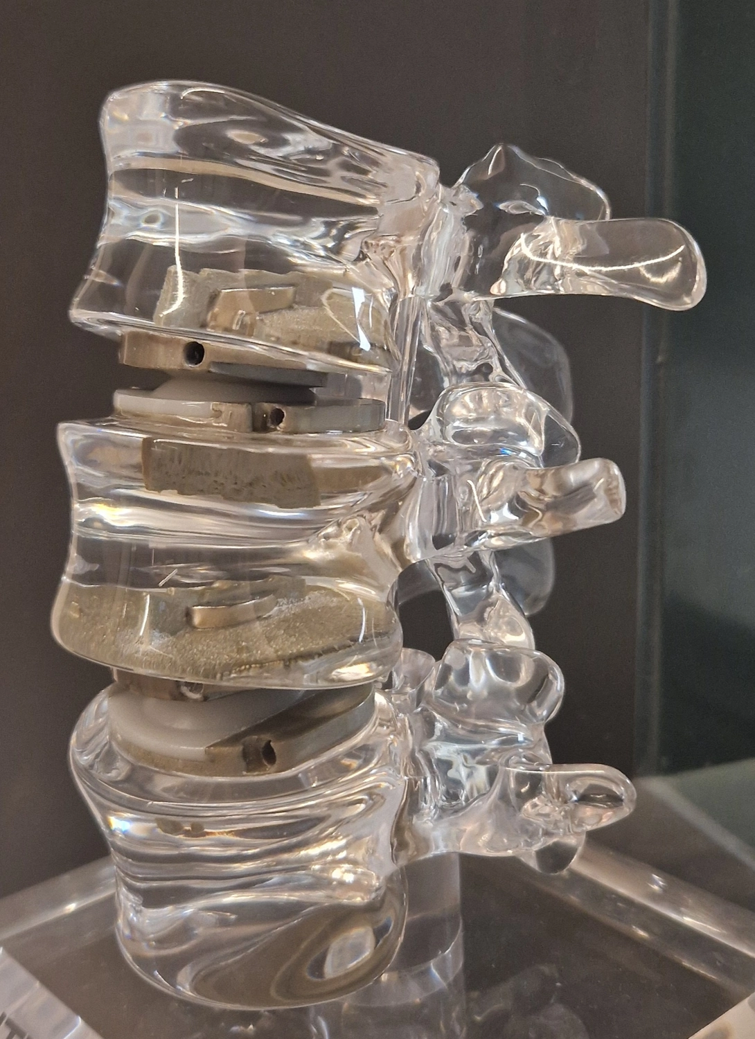 STENUM – Fachklinik für Orthopädie – Röntgenaufnahme der Wirbelsäule mit vertikaler Ausrichtung