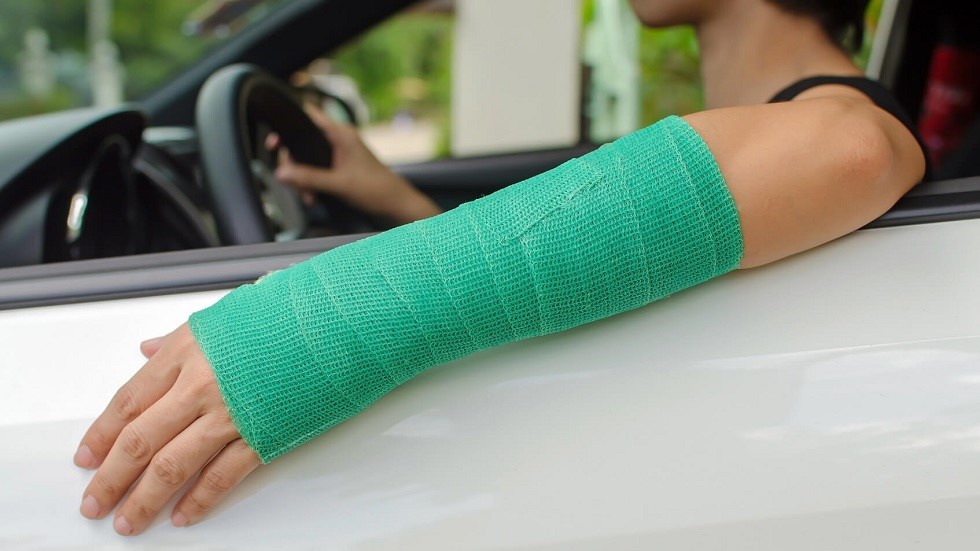 Conductrice platre bras gauche