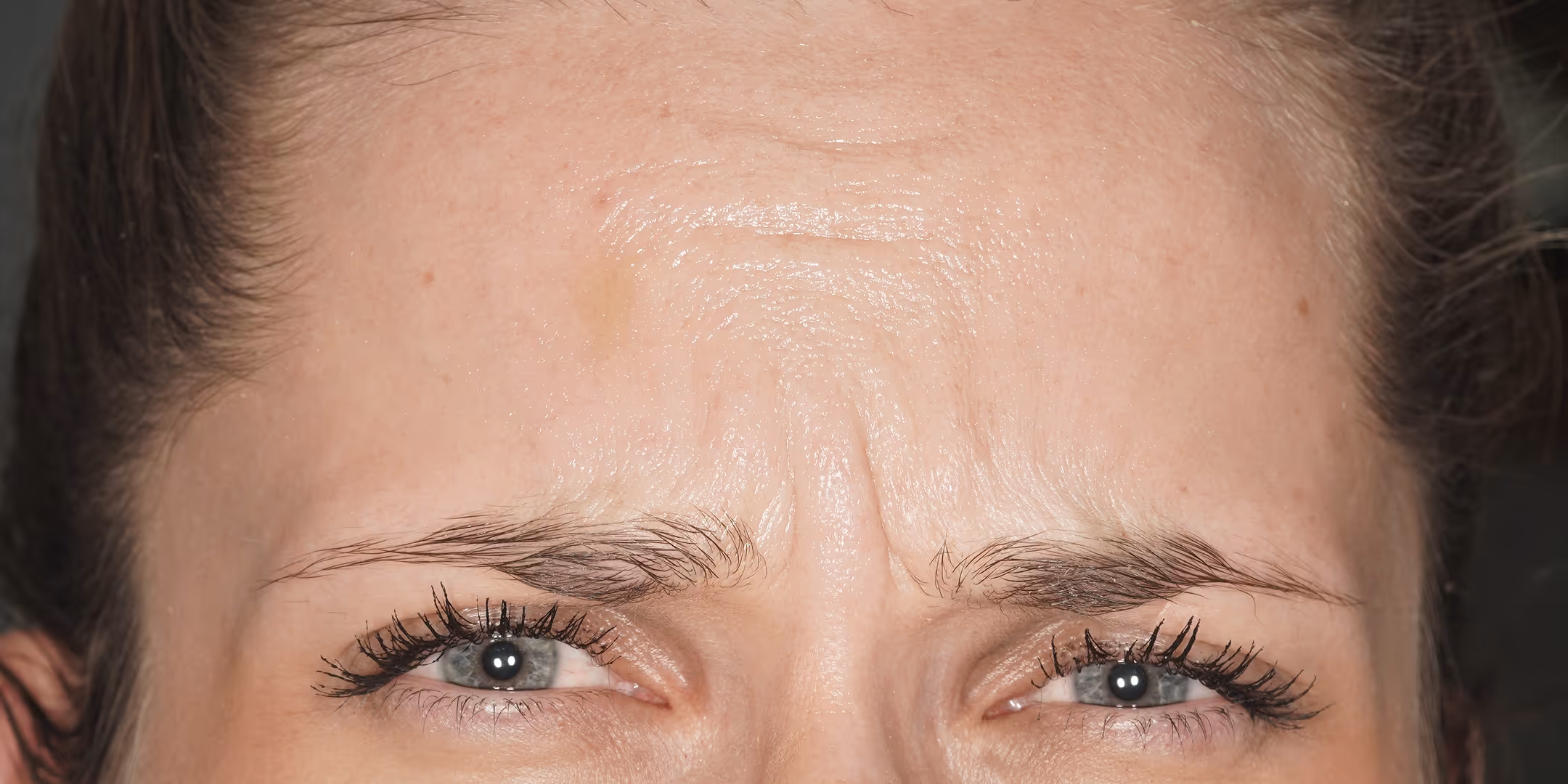 Fotografie před zákrokem