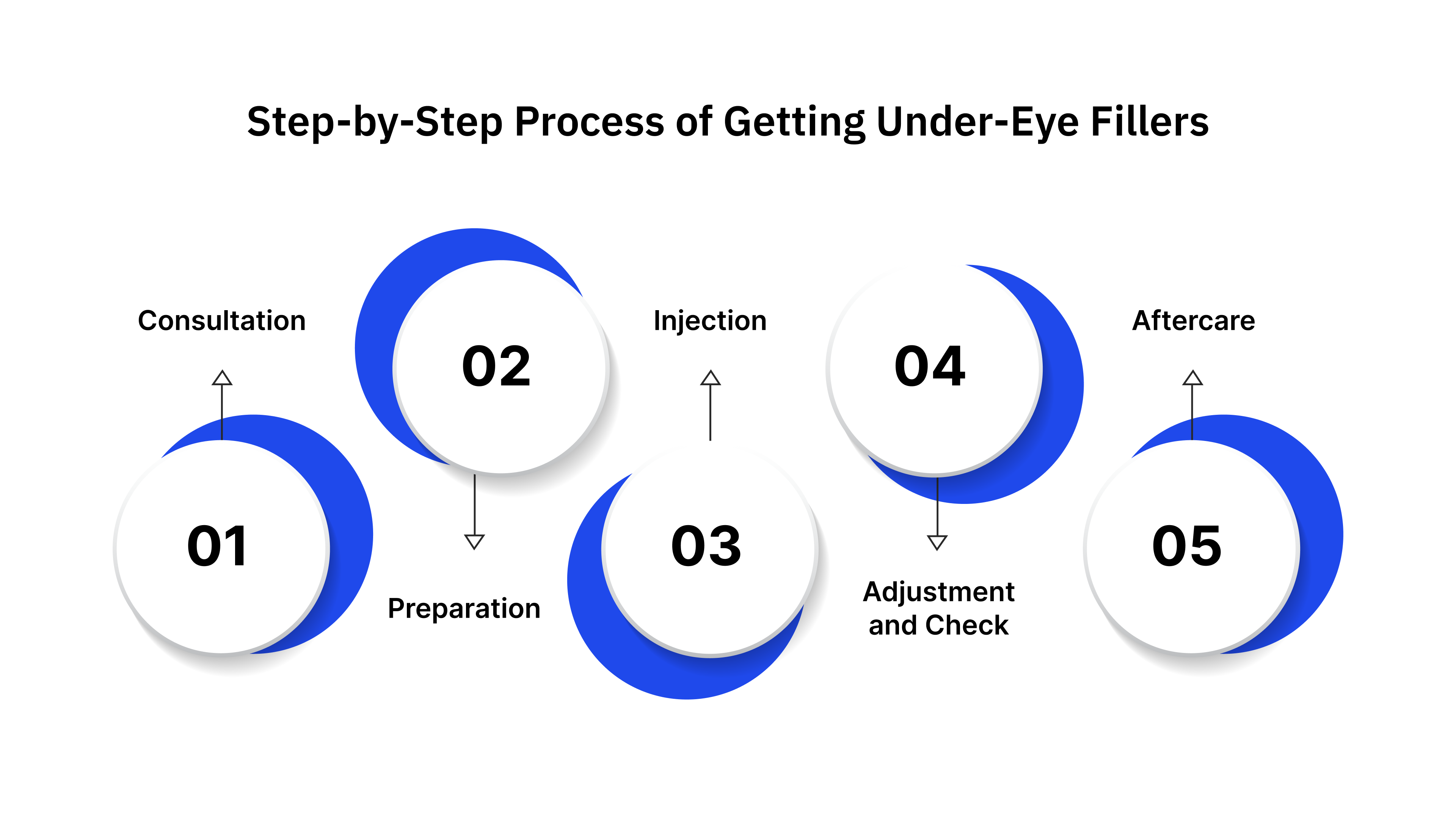 Step-by-Step Process of Getting Under-Eye Fillers
