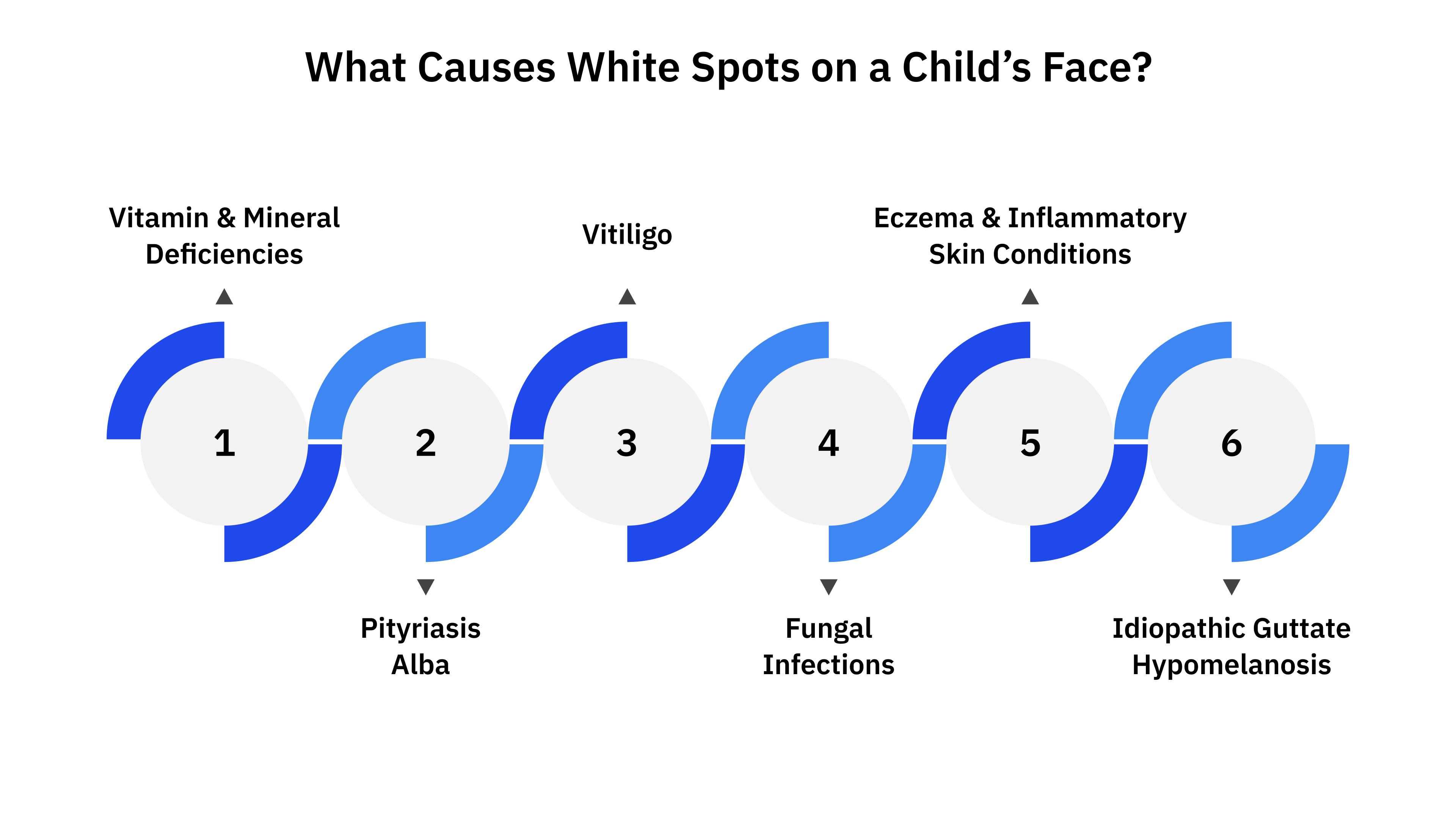 What Causes White Spots on a Child’s Face?