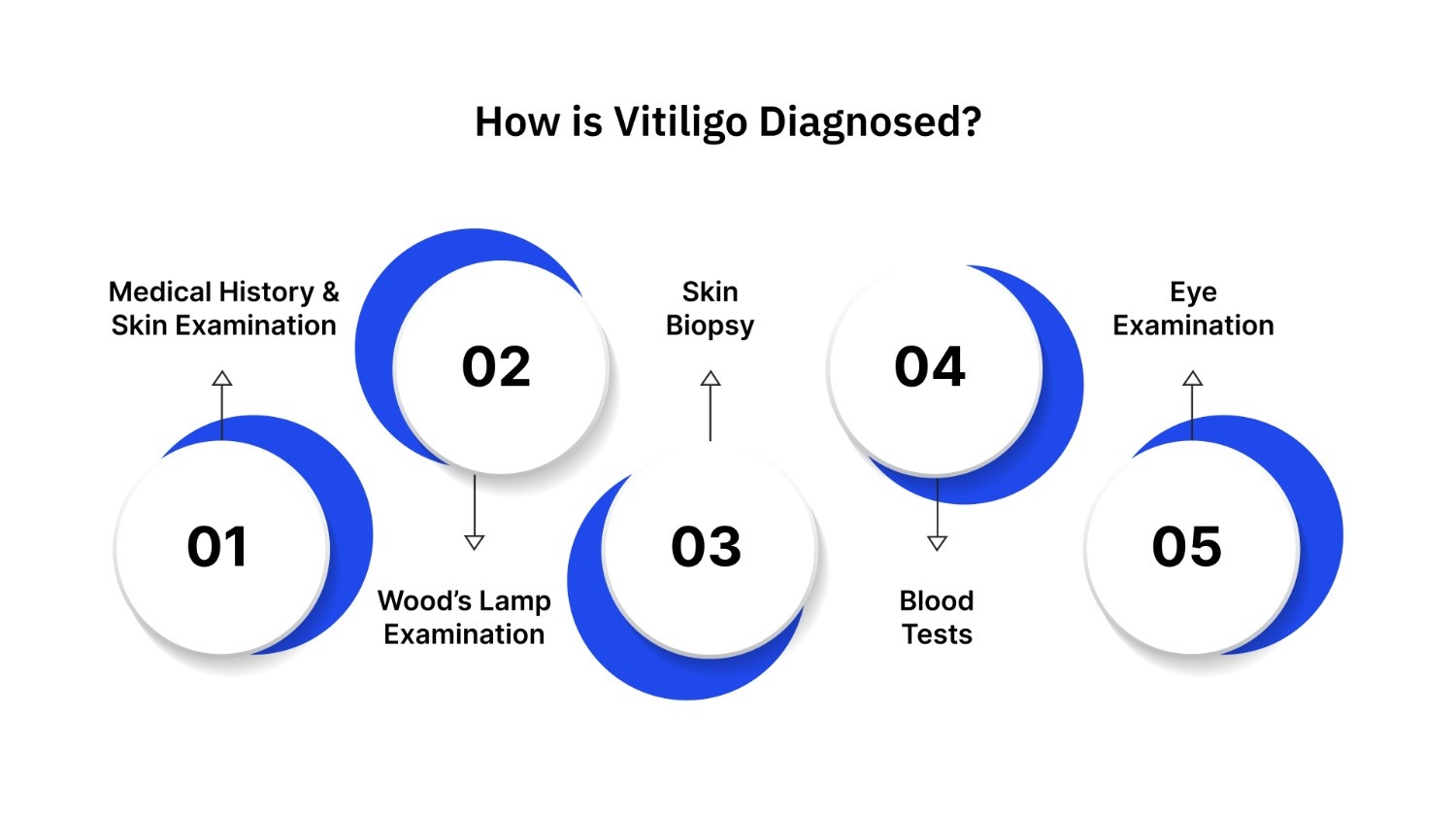 How is Vitiligo Diagnosed?