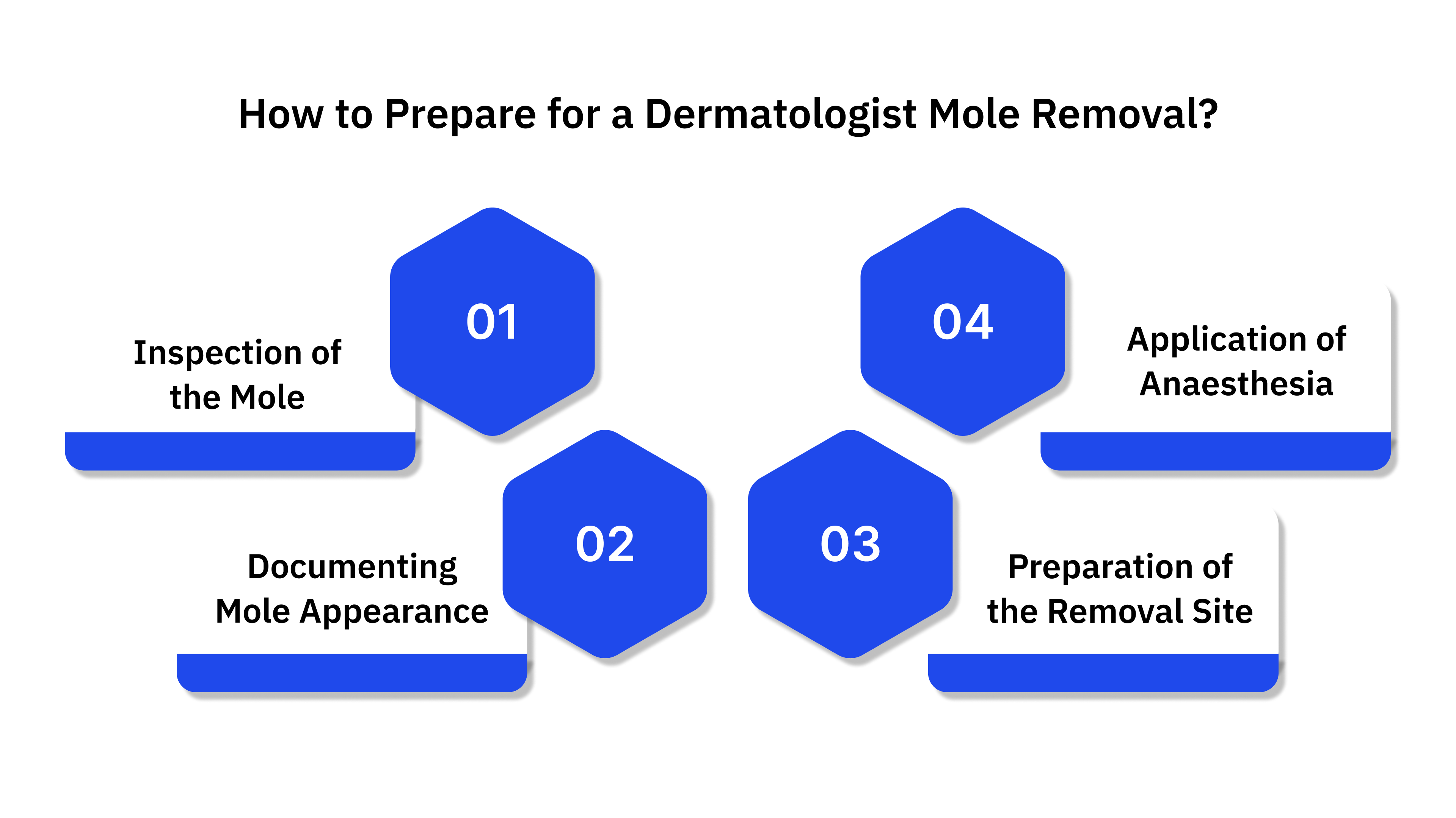 How to Prepare for a Dermatologist Mole Removal