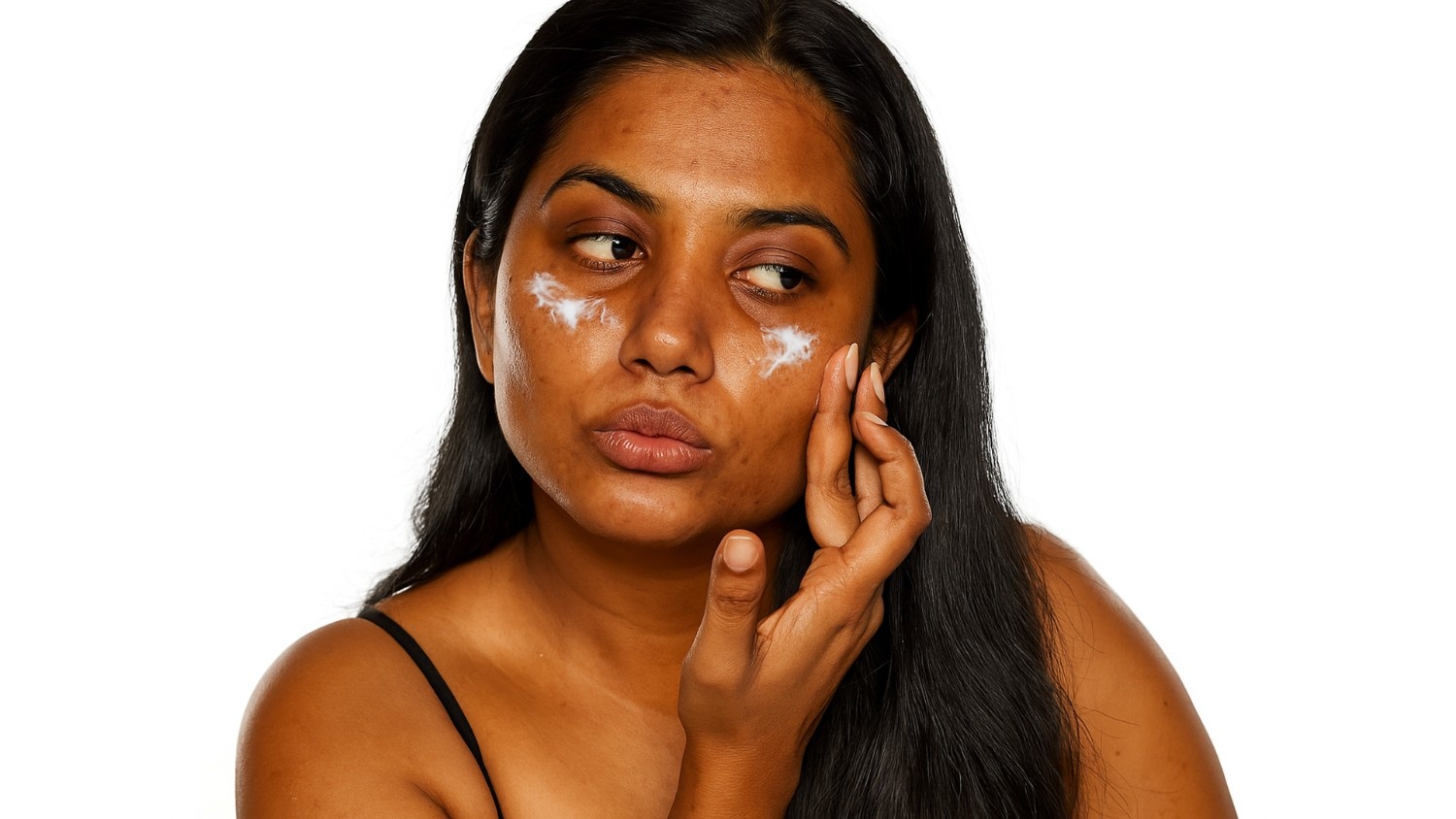 Long-Term Management Strategies for Melasma