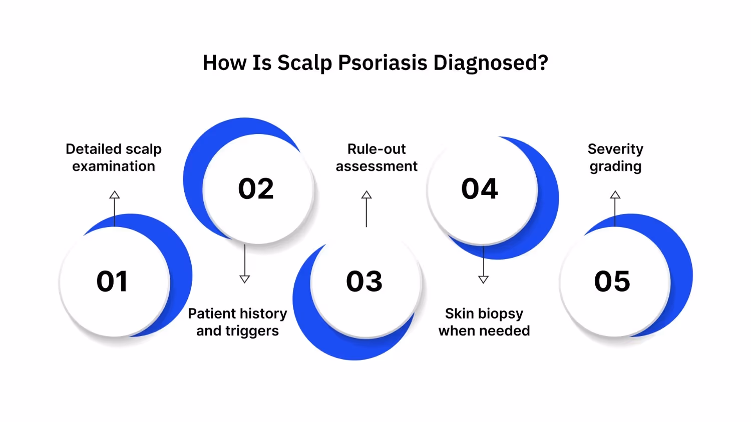 How Is Scalp Psoriasis Diagnosed?