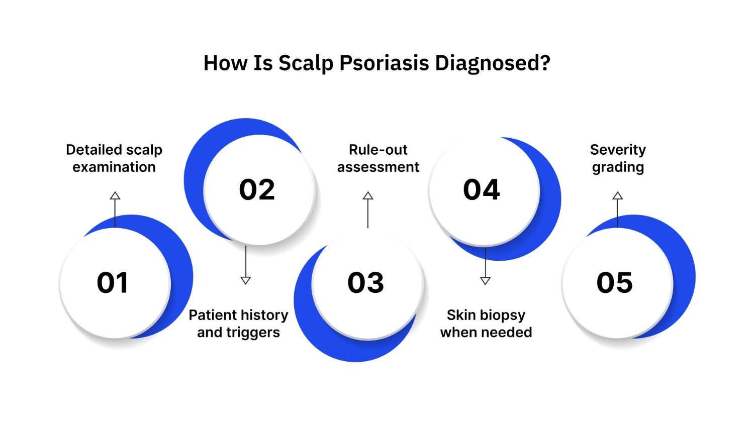 How Is Scalp Psoriasis Diagnosed?