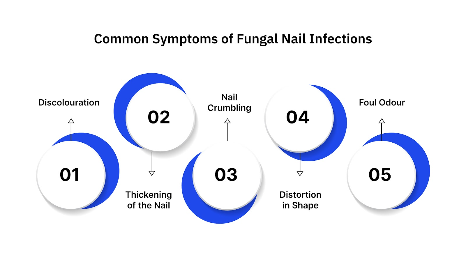 Common Symptoms of Fungal Nail Infections