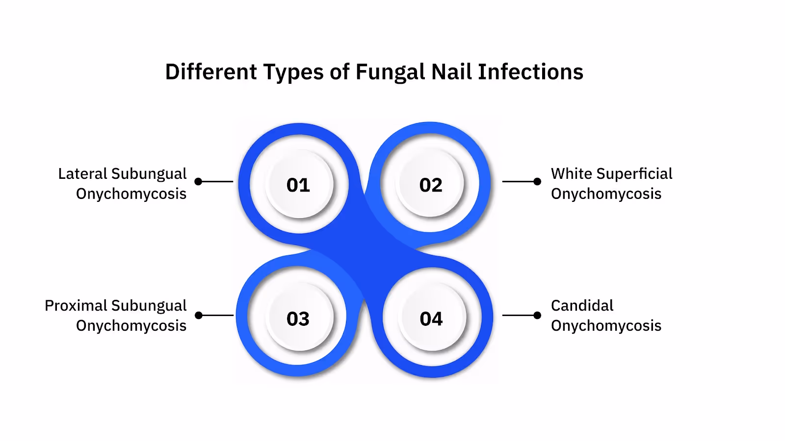 Different Types of Fungal Nail Infections