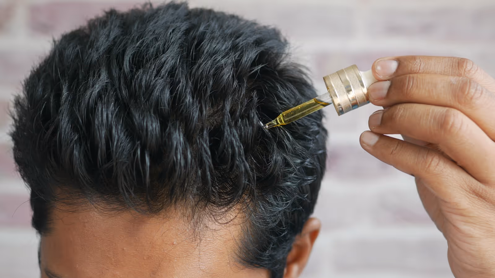 Top 10 Effective Hair Loss Treatment for Men to Consider