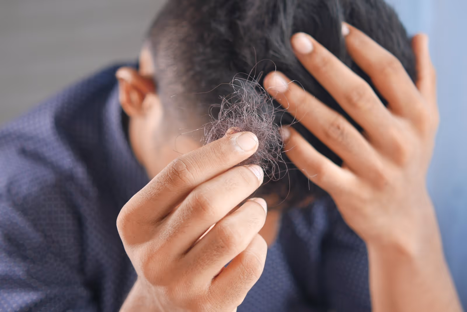 Is Hair Loss Affecting Your Confidence?