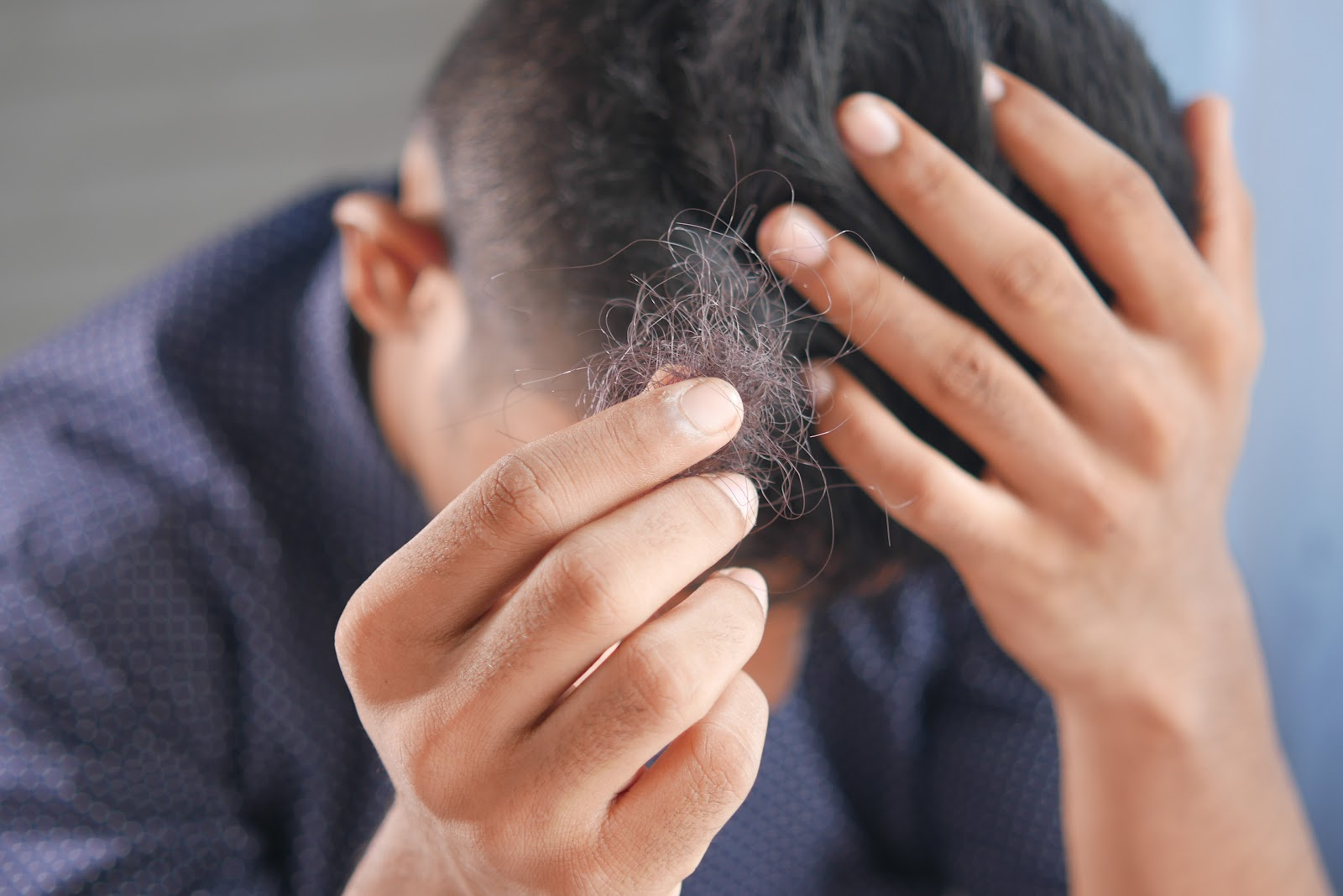 Is Hair Loss Affecting Your Confidence?
