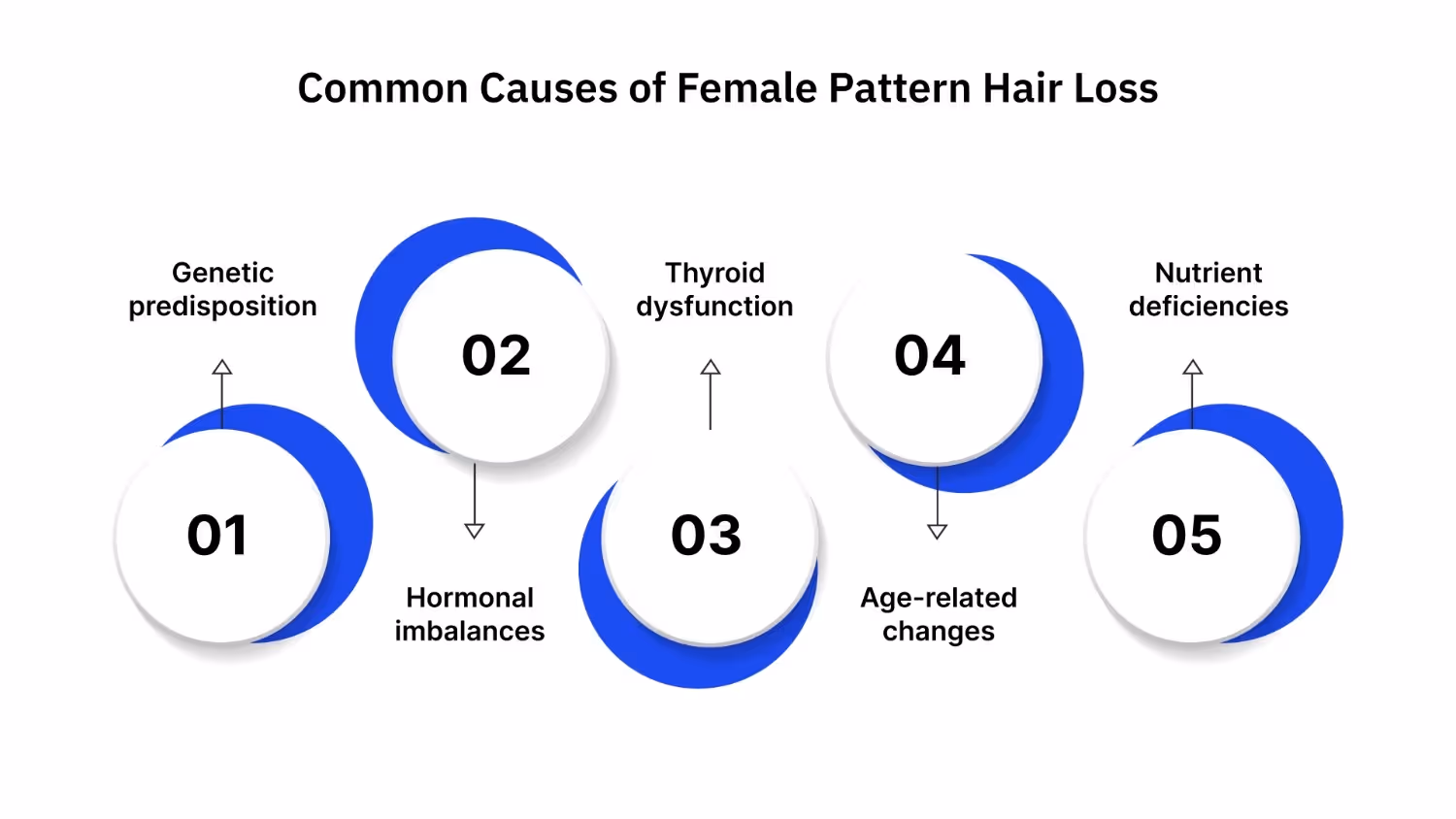 Common Causes of Female Pattern Hair Loss