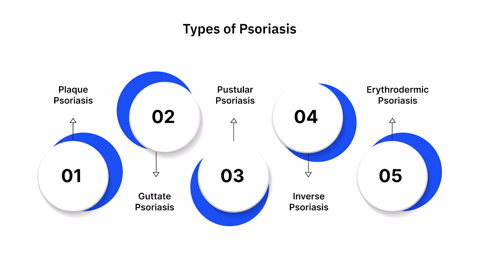 Types of Psoriasis