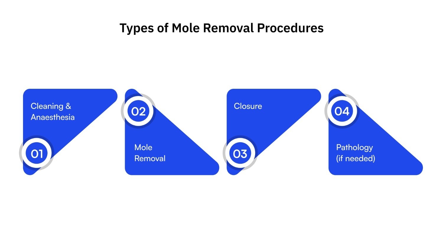 Procedure Duration & Steps