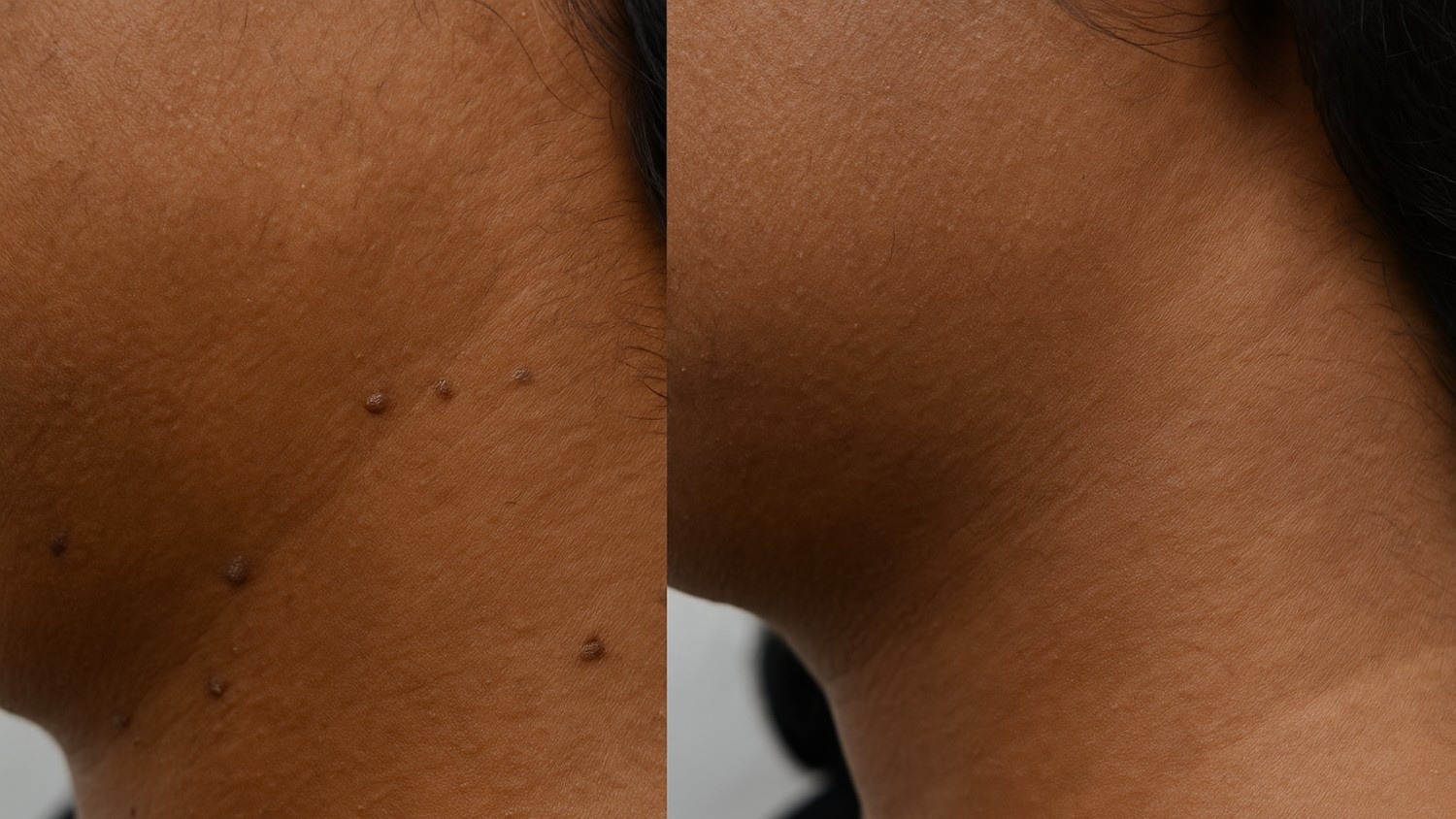 What to Expect During and After Treatment