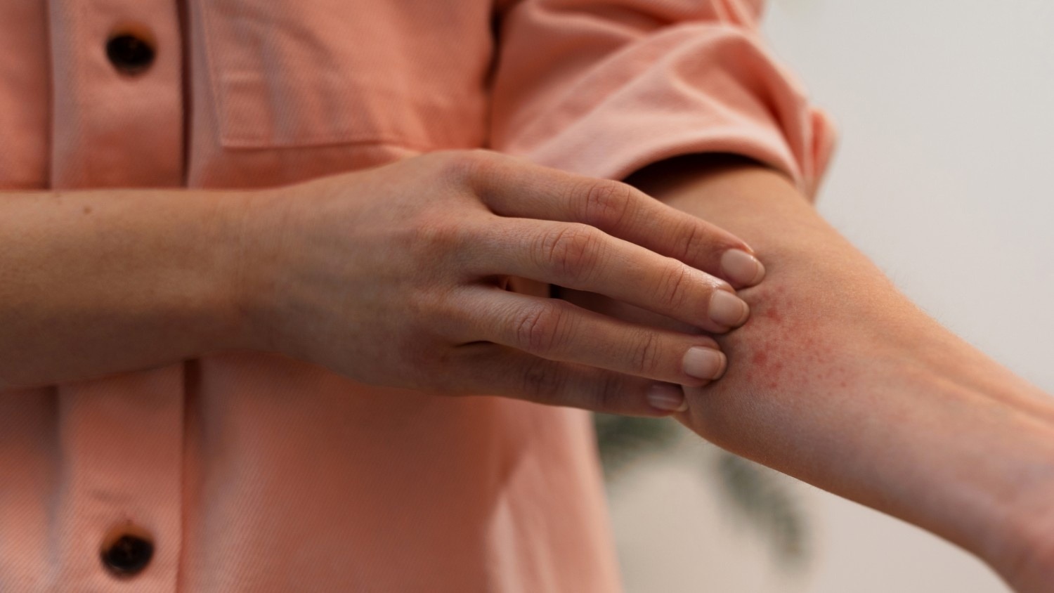 10 Best Doctors for Fungal Infections in Chennai