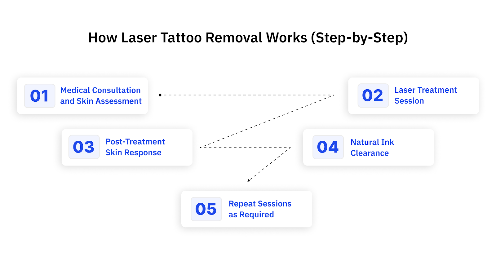 How Laser Tattoo Removal Works (Step-by-Step)