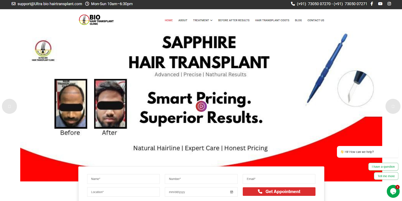 Ultra Bio Hair Transplant Clinic