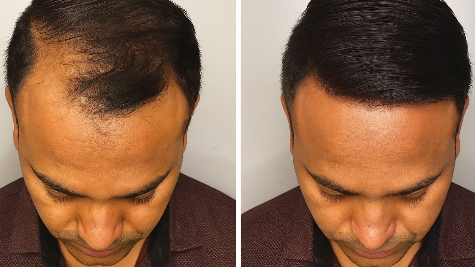 What to Expect Before and After Treatment