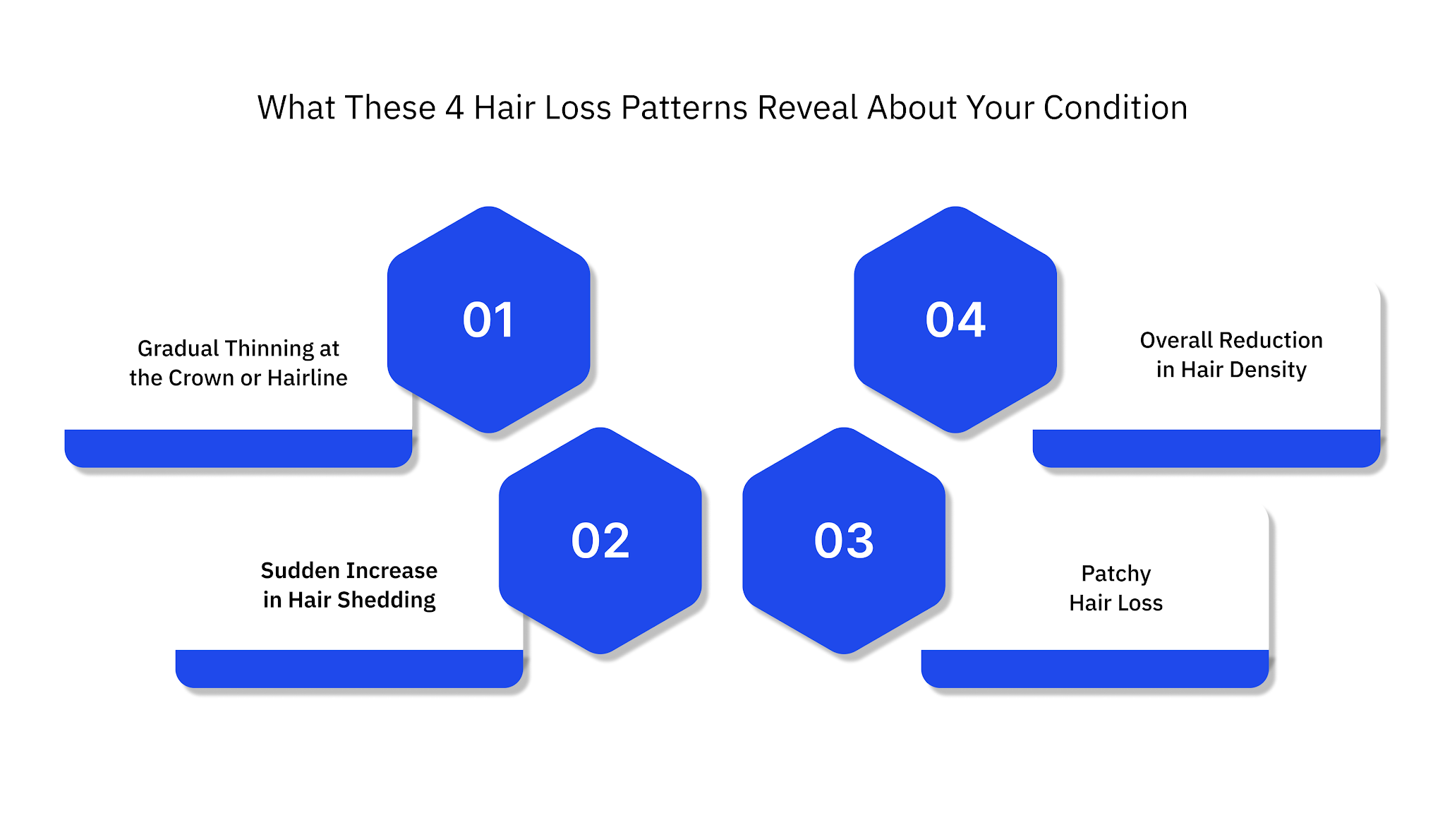 What These 4 Hair Loss Patterns Reveal About Your Condition