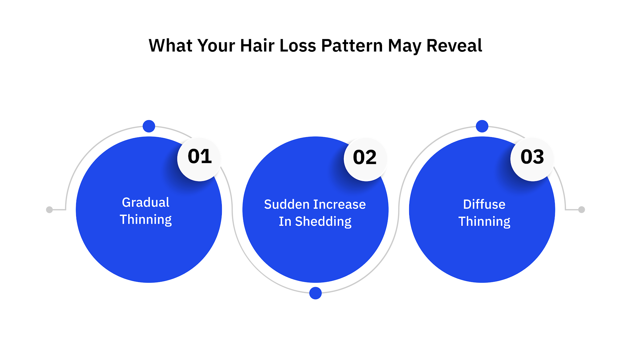 What Your Hair Loss Pattern May Reveal