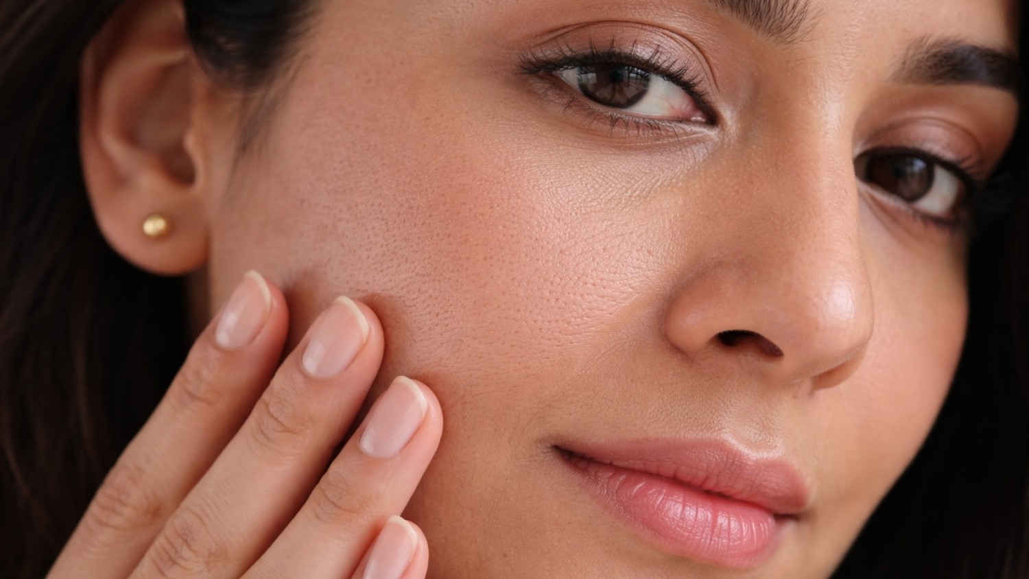 Enlarged Pores