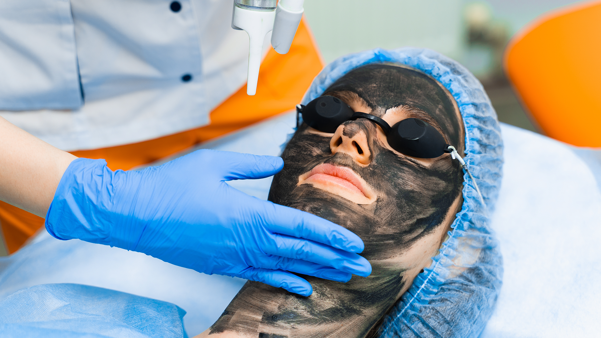 Carbon Peel Laser