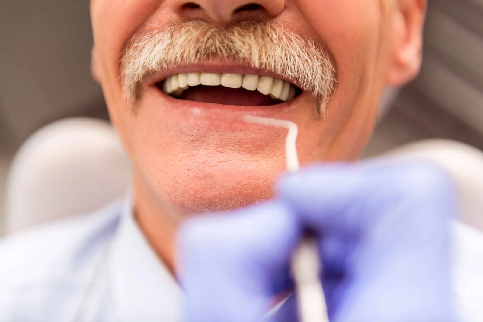 older man with implant-supported dentures